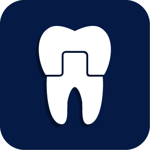 Best Dentist in Logan Utah - Crowns