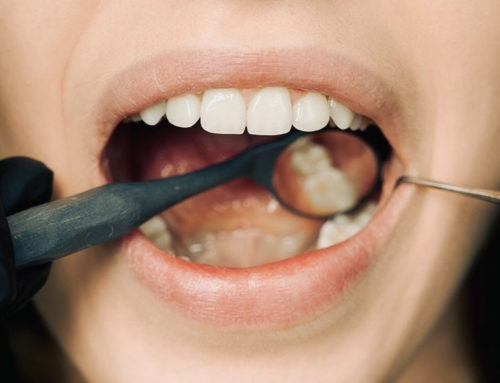 The importance of regular dental check-ups