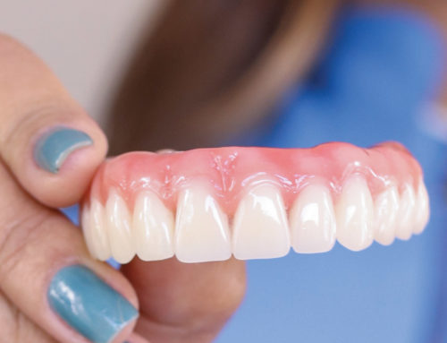 What are Dentures?