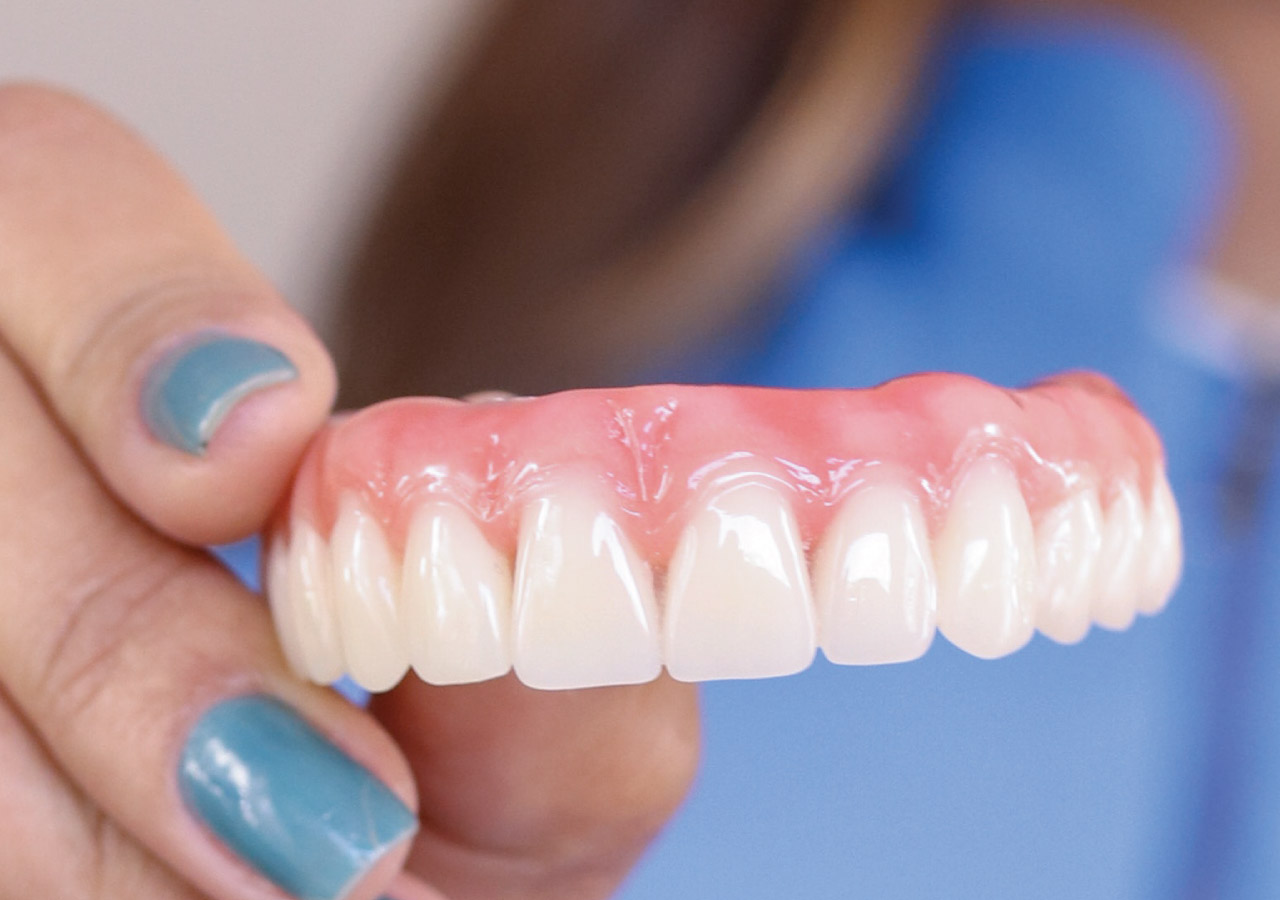 Dentures replace natural teeth with artificial teeth to improve smile and restore ability to chew, speak and bite properly.