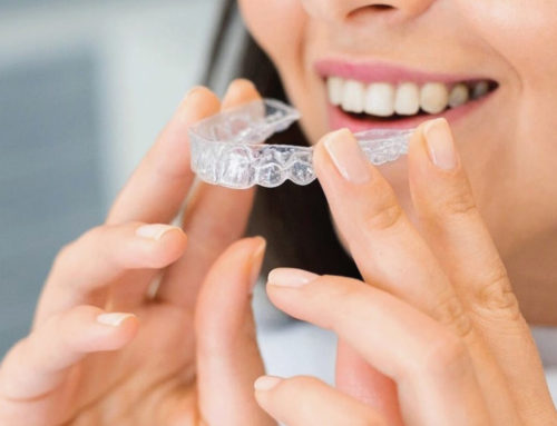What is Invisalign?