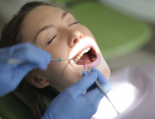 Why Have Dental Cleanings Every 6 Months?